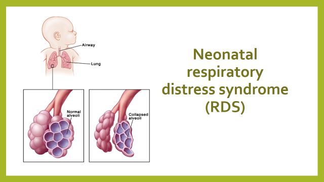Hội chứng suy hô hấp (respiratory distress syndrome - RDS)