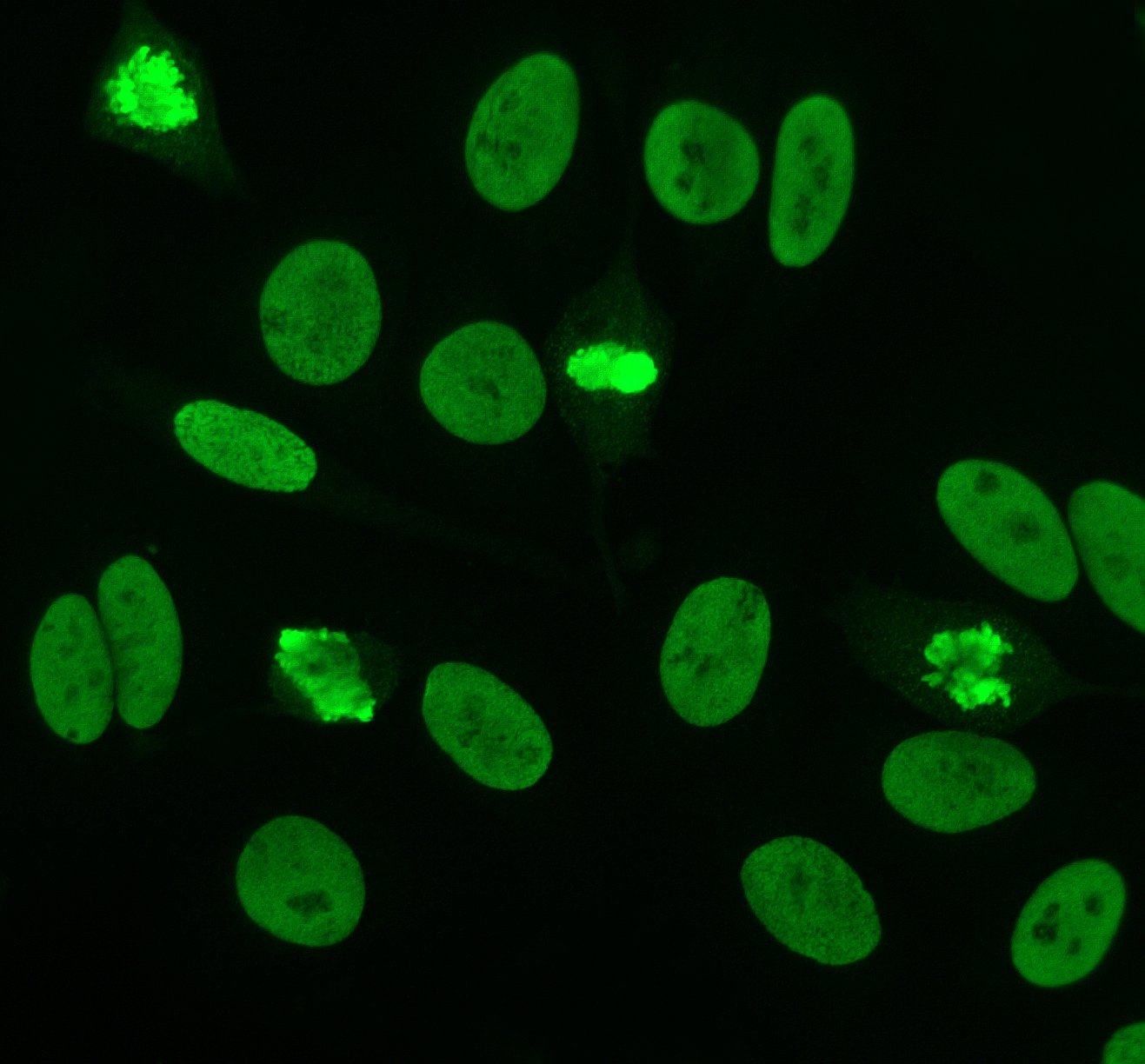 Mẫu nhuộm miễn dịch huỳnh quang đồng nhất của kháng thể DNA sợi đôi trên các tế bào HEp-20-10
