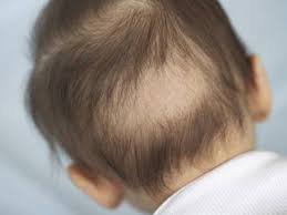 Trẻ sơ sinh bị rụng tóc vành khăn cho uống canxi và vitamin D3 + K2 được không?