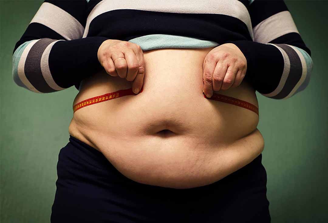 Phụ nữ béo phì giảm cân