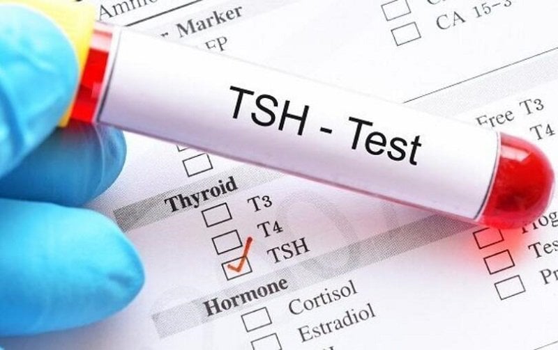 Kết quả xét nghiệm TSH: 1, FT4: 42.62, FT3: 5.12 cho biết bệnh lý gì?