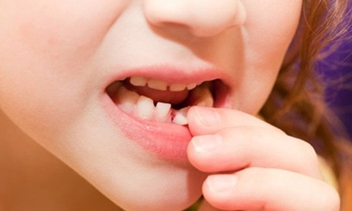 Trình tự thay răng sữa ở trẻ em