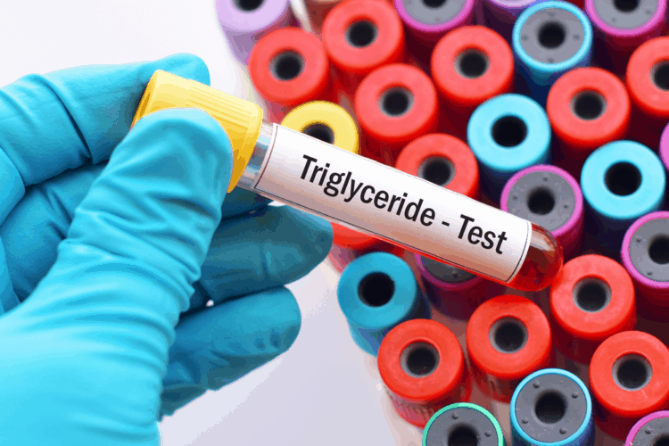 triglyceride trong máu cao