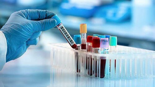 Bác sĩ có thể ước tính lượng máu của bạn dựa trên một số xét nghiệm.