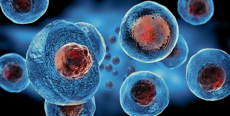 Thư mời tham gia thử nghiệm lâm sàng: Ghép tế bào gốc điều trị bệnh phổi tắc nghẽn mạn tính