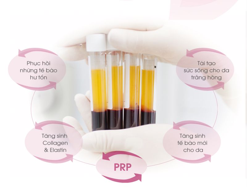 Trẻ hóa làn da với huyết tương giàu tiểu cầu (PRP)