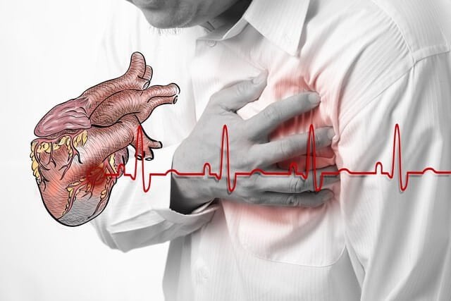 Suy tim độ 1 không còn nguy hiểm nếu phát hiện sớm và điều trị kịp thời