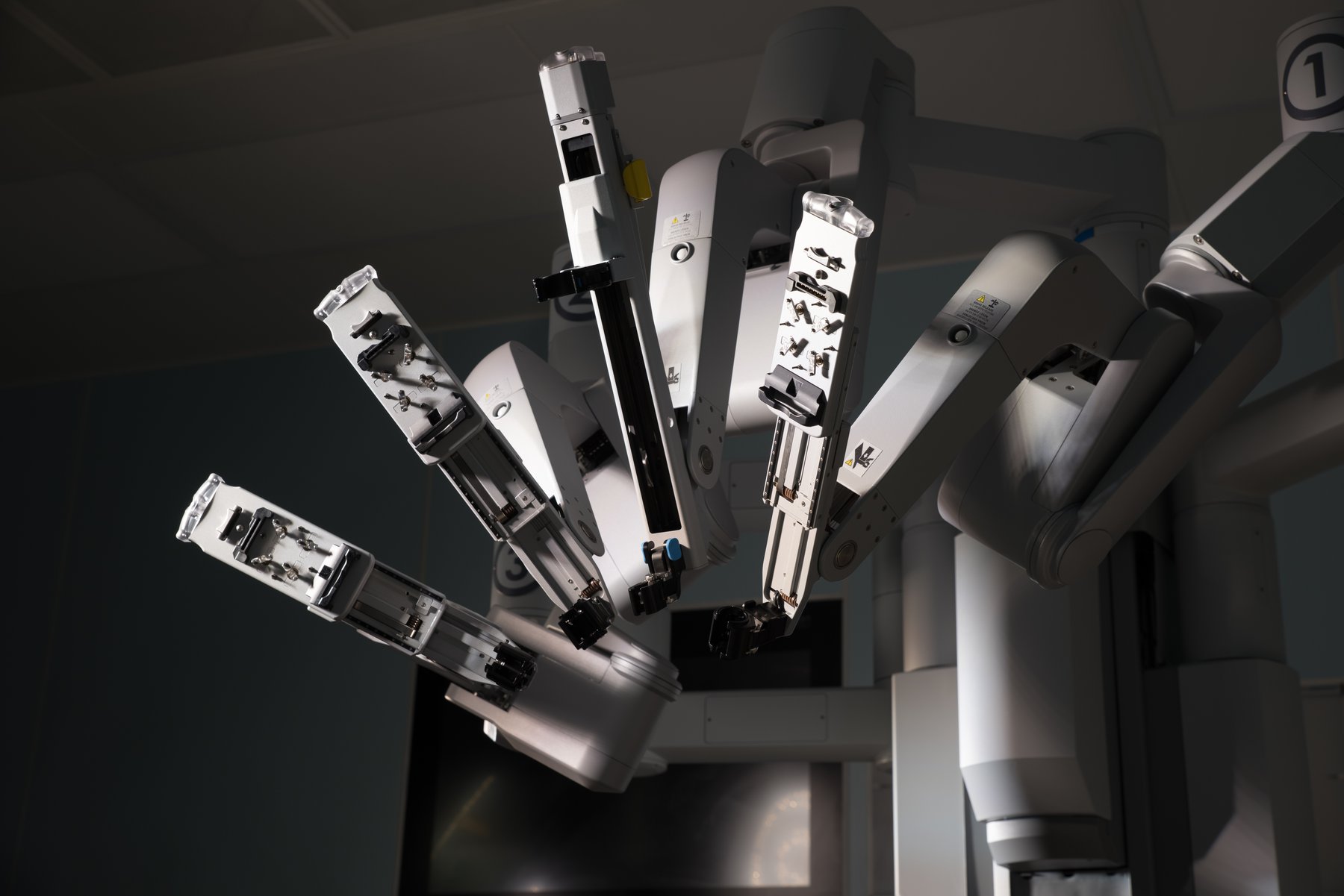 Vì sao phẫu thuật Robot chiếm nhiều ưu điểm so với phẫu thuật mổ hở và nội soi cổ điển?
