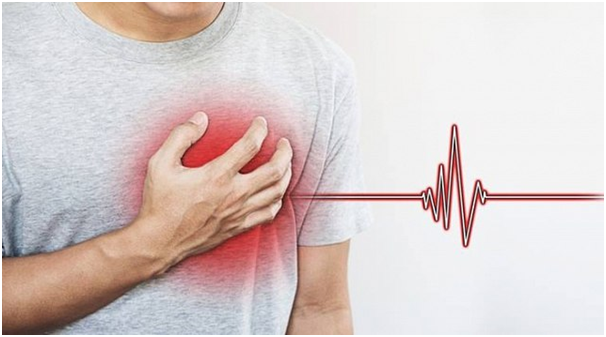 Hướng dẫn tiếp cận và xử trí nhồi máu cơ tim cấp