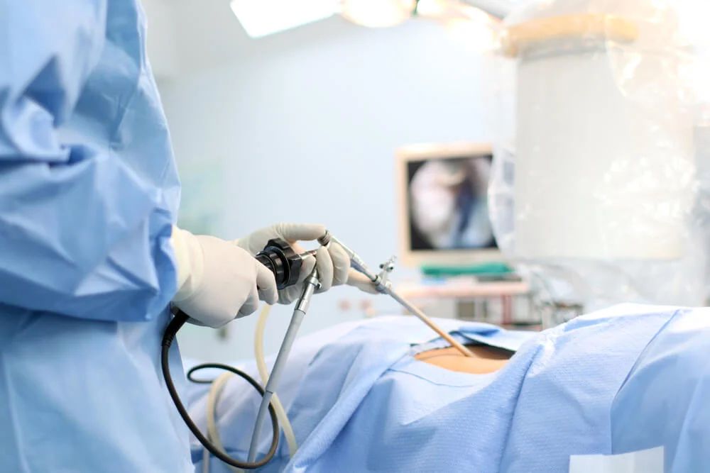 Phẫu thuật nội soi cắt tử cung