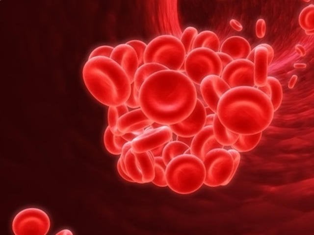 Hội chứng Antiphospholipid làm tăng độ đông máu quá mức