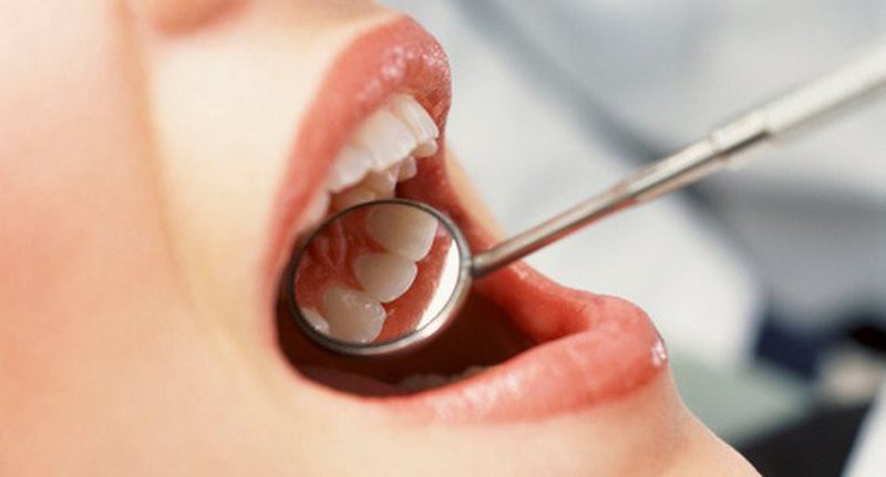 Chảy máu chân răng: Dấu hiệu nặng của sốt xuất huyết