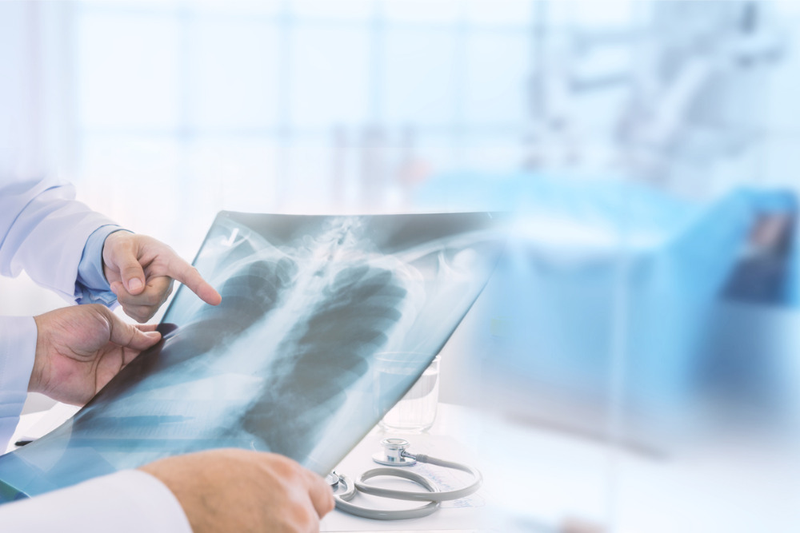 Dấu hiệu ung thư phổi di căn xương - tiên lượng điều trị