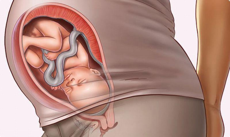 Ngôi thuận của thai nhi là gì?