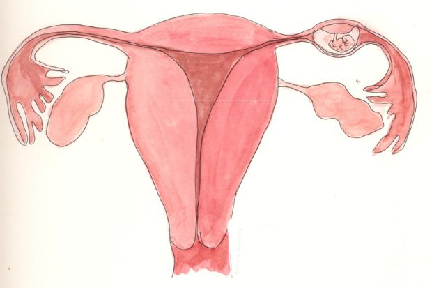 Nguy cơ mang thai ngoài tử cung do viêm vùng chậu
