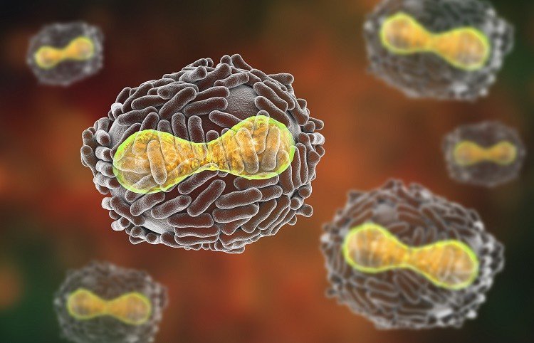 Bệnh đậu mùa do nhiễm virus variola