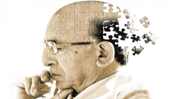 Chẩn đoán và điều trị bệnh sa sút trí tuệ ở người cao tuổi | Vinmec
