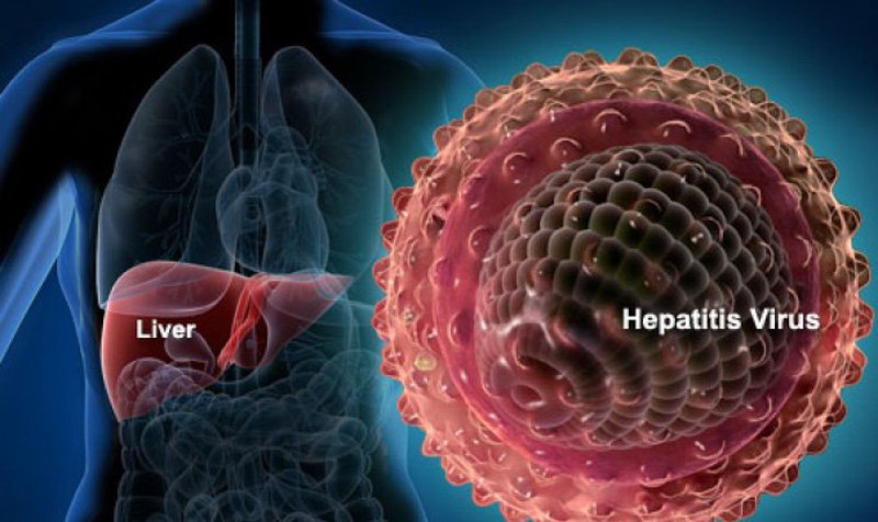 Virus viêm gan B có khả năng lây truyền cao gấp 50-100 lần so với virus HIV