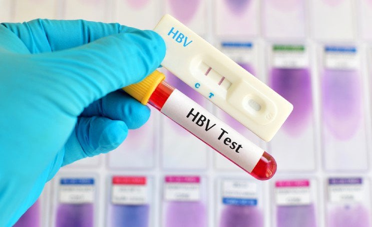 Xét nghiệm viêm gan HBV