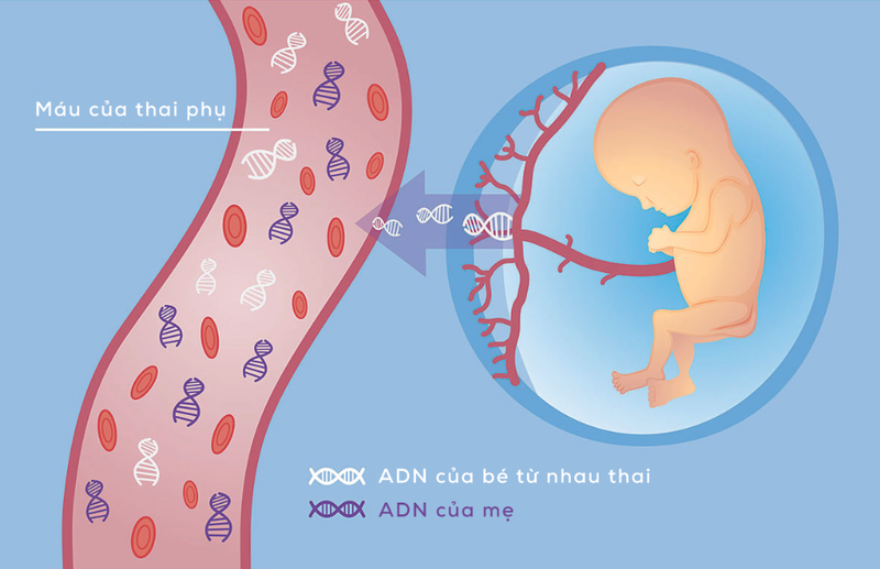 Xét nghiệm sàng lọc trước sinh không có DNA