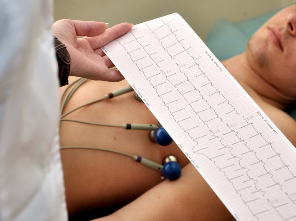 Vai trò của điện tâm đồ trong chẩn đoán nhồi máu cơ tim
