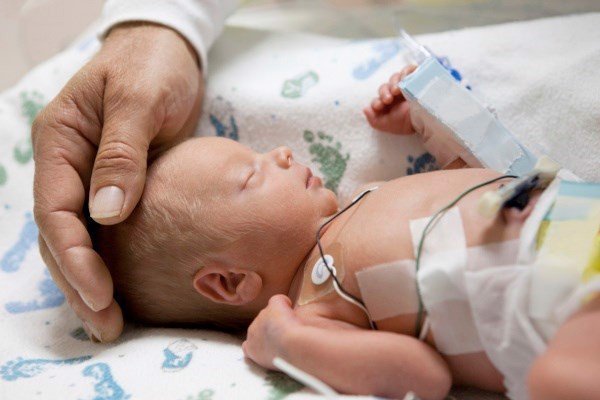 Trẻ sinh non bị suy hô hấp cấp