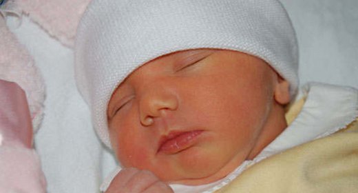 Phân biệt vàng da sinh lý và vàng da do teo đường mật ở trẻ sơ sinh