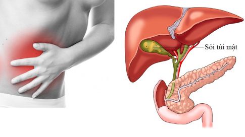 Tìm hiểu hiện tượng triglyceride máu trong viêm tụy cấp