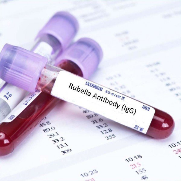 Những điều cần biết về xét nghiệm Rubella (IgM và IgG) ở thai phụ