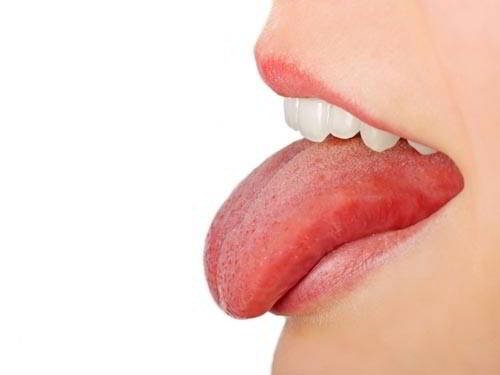 Dấu hiệu ung thư lưỡi