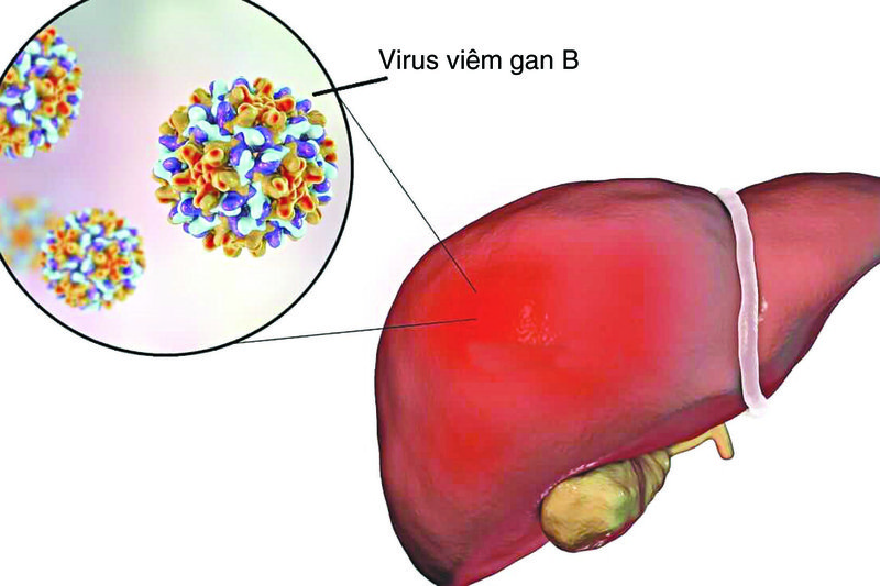 Thế nào là phơi nhiễm viêm gan B?