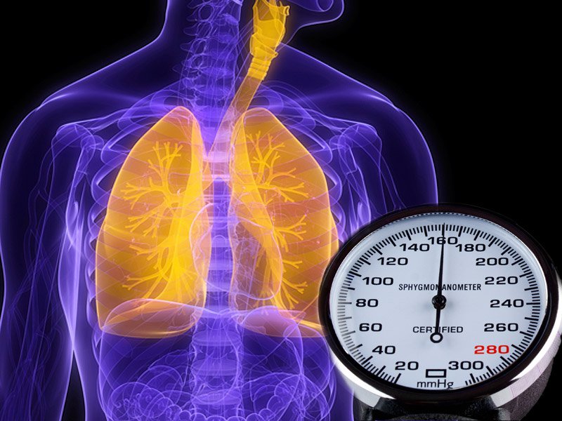 Tiêu chuẩn chẩn đoán tăng áp phổi