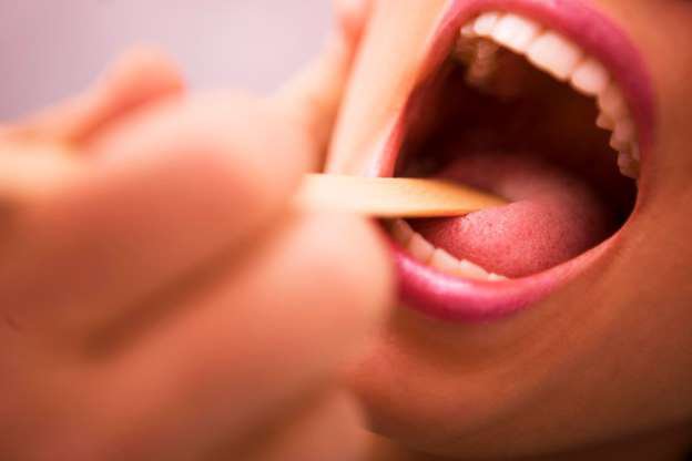 Viêm họng: Bệnh tưởng nhẹ nhưng chớ coi thường
