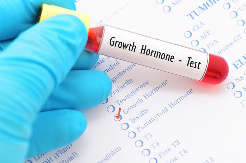 Vai trò của xét nghiệm hormone tăng trưởng (GH)