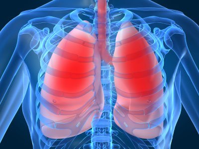 Viêm màng phổi và điều trị