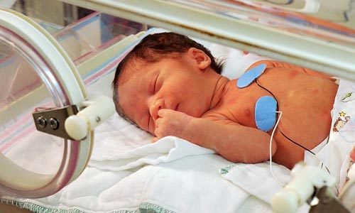Những yếu tố đánh giá tình trạng suy hô hấp ở trẻ sơ sinh