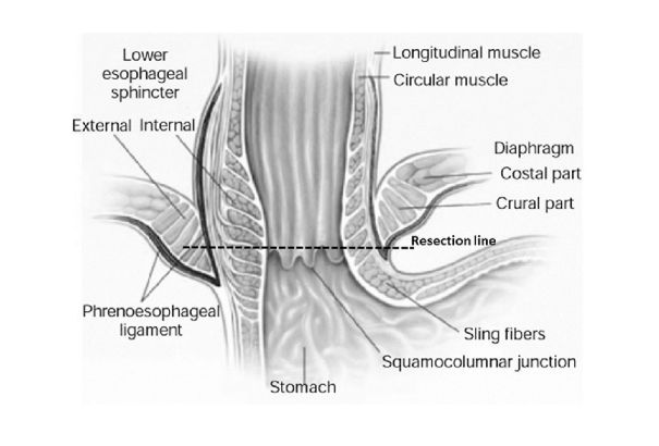 Giải phẫu vùng cơ thắt dưới thực quản