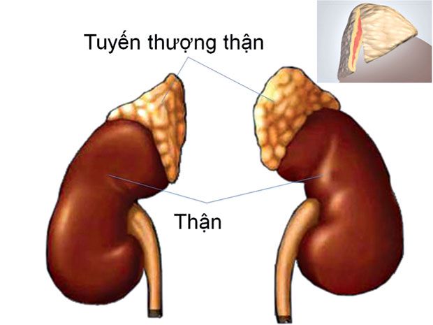 Biến chứng của suy tuyến thượng thận mạn tính