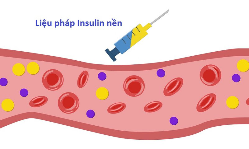 Liệu pháp insulin nền