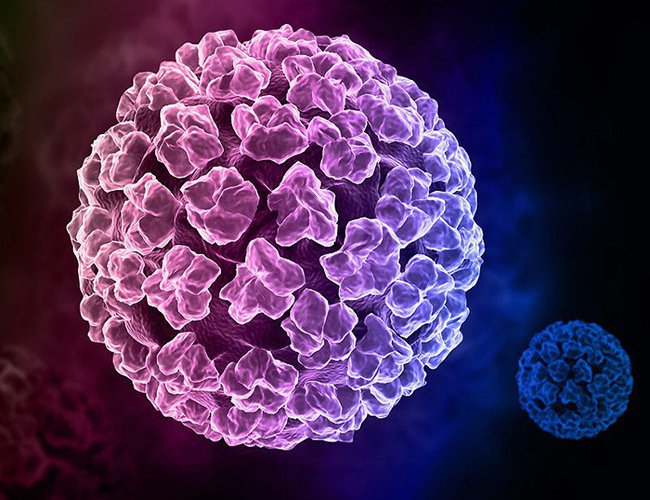 Mụn cóc sinh dục do vi khuẩn HPV chủng 6 và 11 gây ra