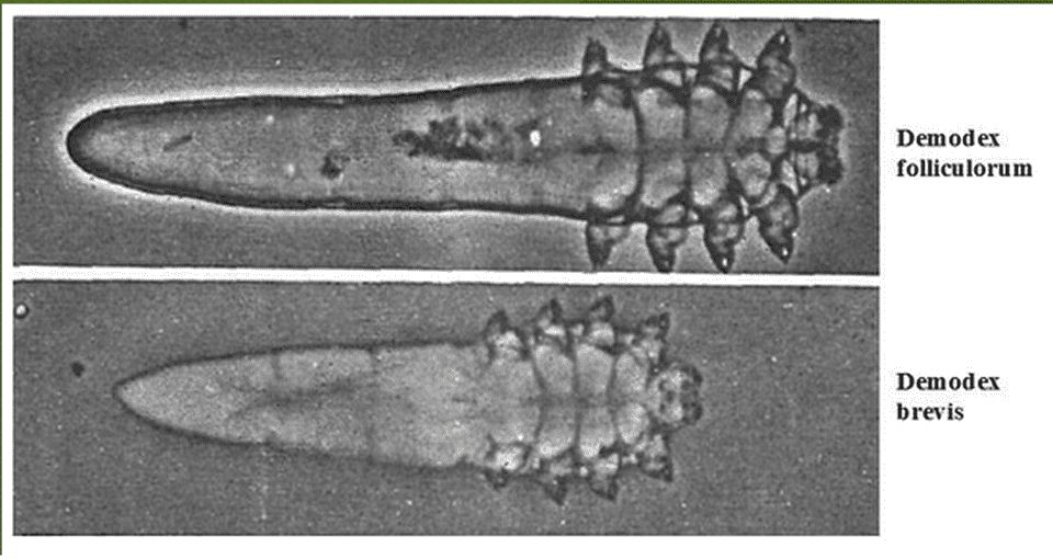 Vi khuẩn demodex