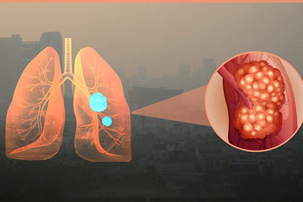 Ô nhiễm không khí