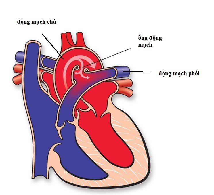 Ống động mạch