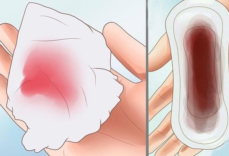 Ra máu nâu sau uống thuốc tránh thai khẩn cấp