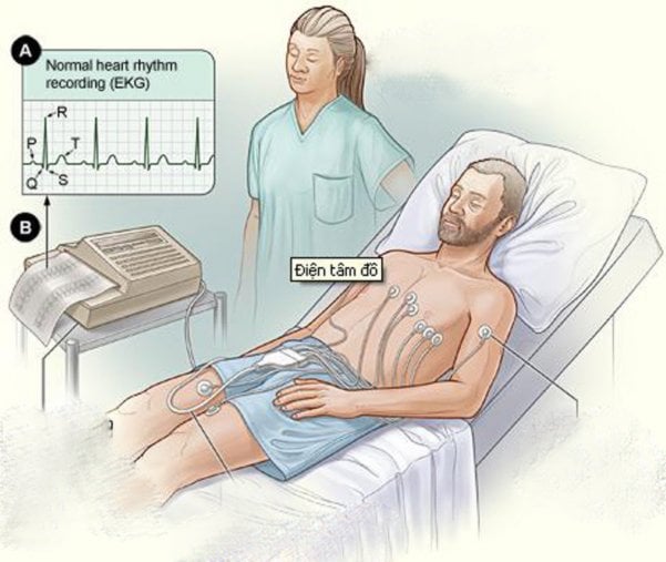 Ghi điện tim cấp cứu tại giường