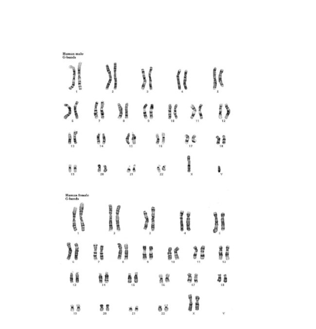 Karyotype bình thường ở nam giới và nữ giới (Cytogenetics Gallery)