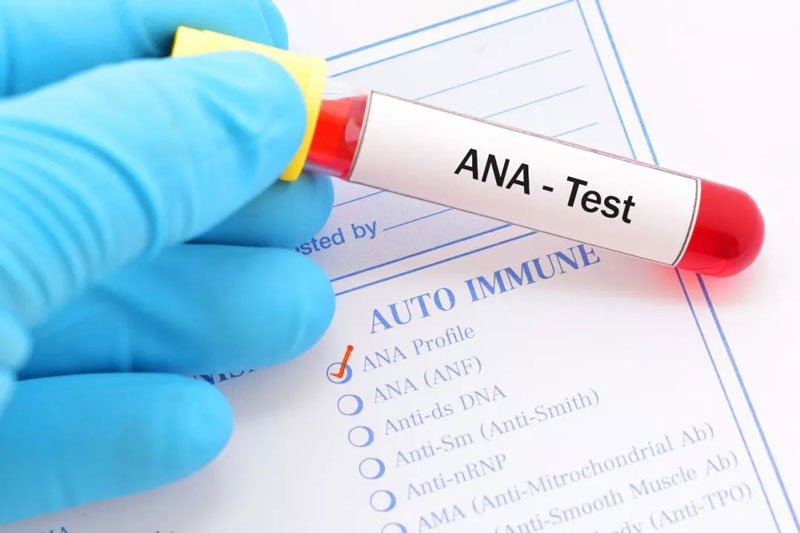 Xét nghiệm kháng thể kháng nhân ANA