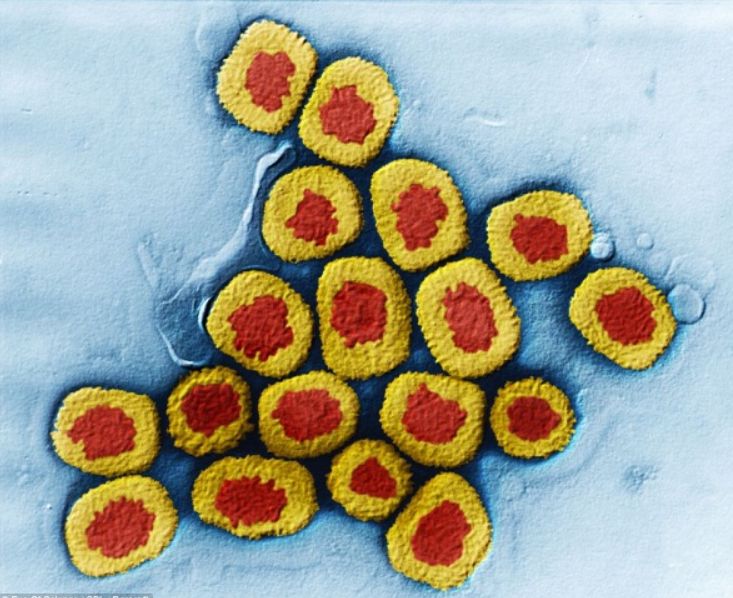 Virus đậu mùa