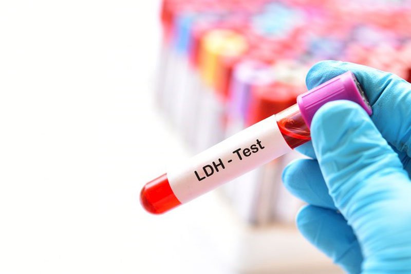 xét nghiệm LDH