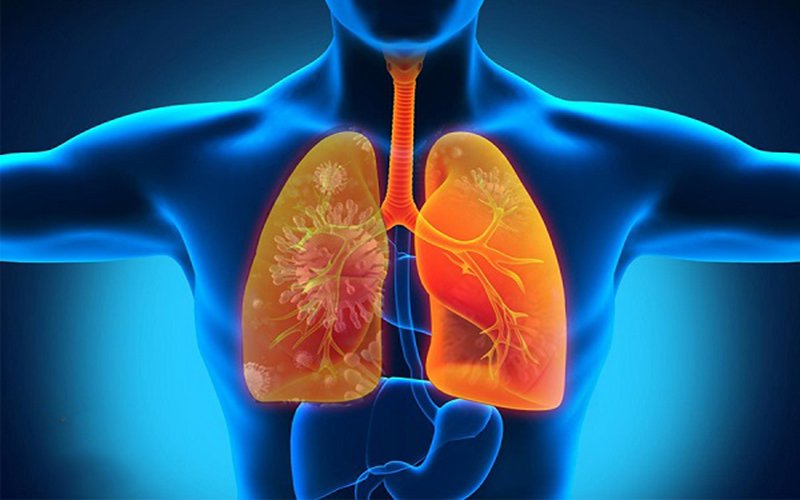 bệnh viêm phổi hít